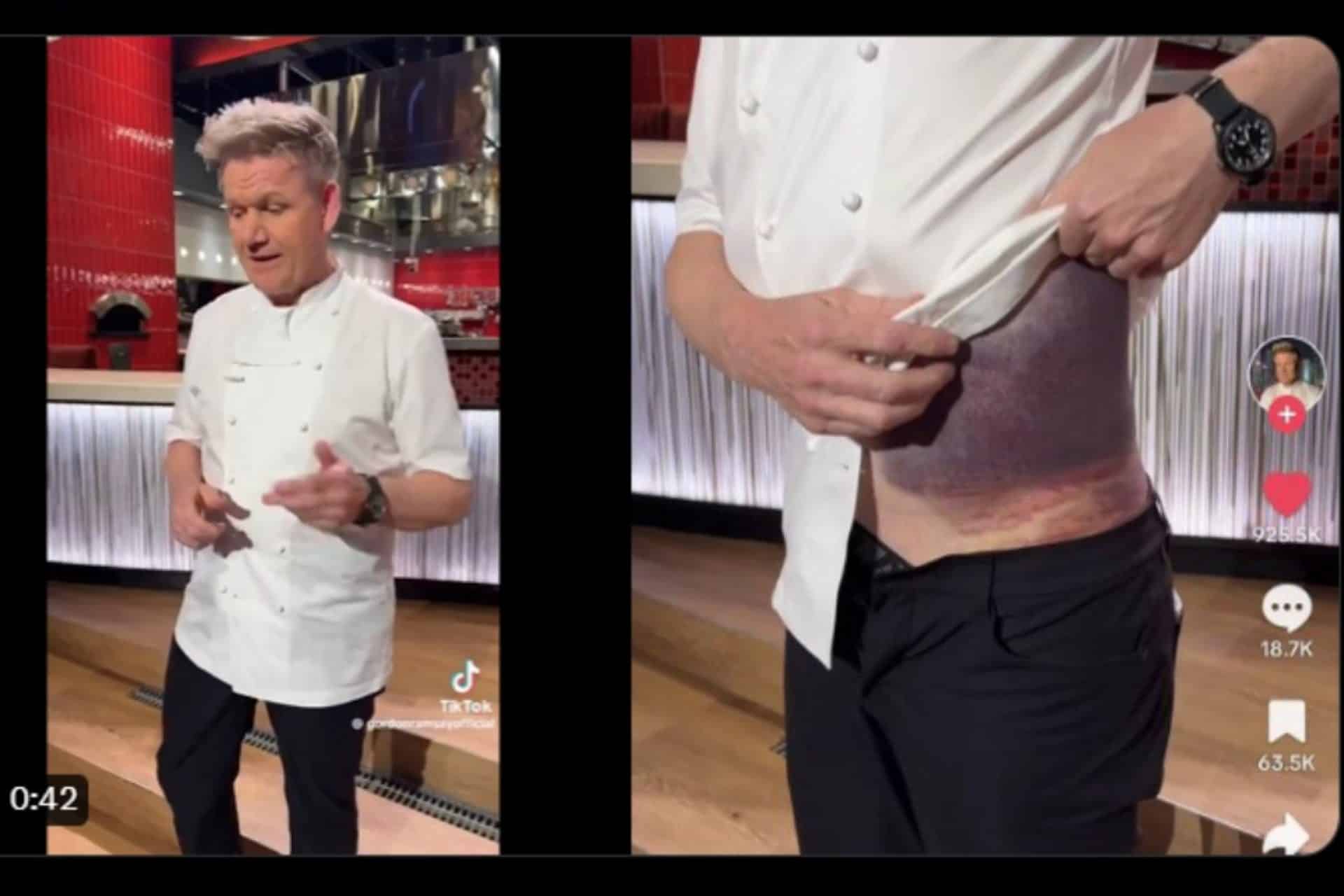 Gordon Ramsay accidente