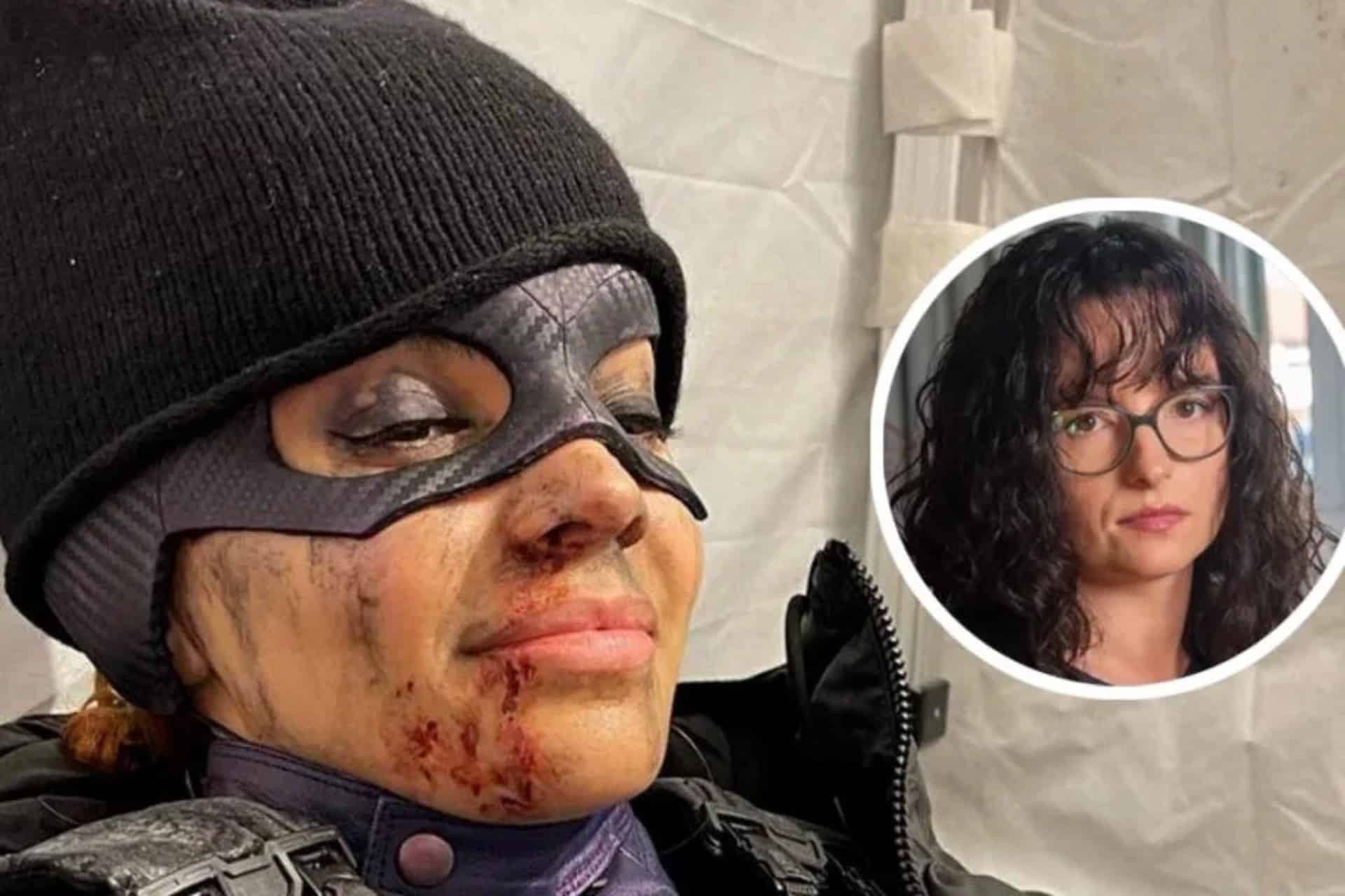Compensation for filming accident in Batgirl