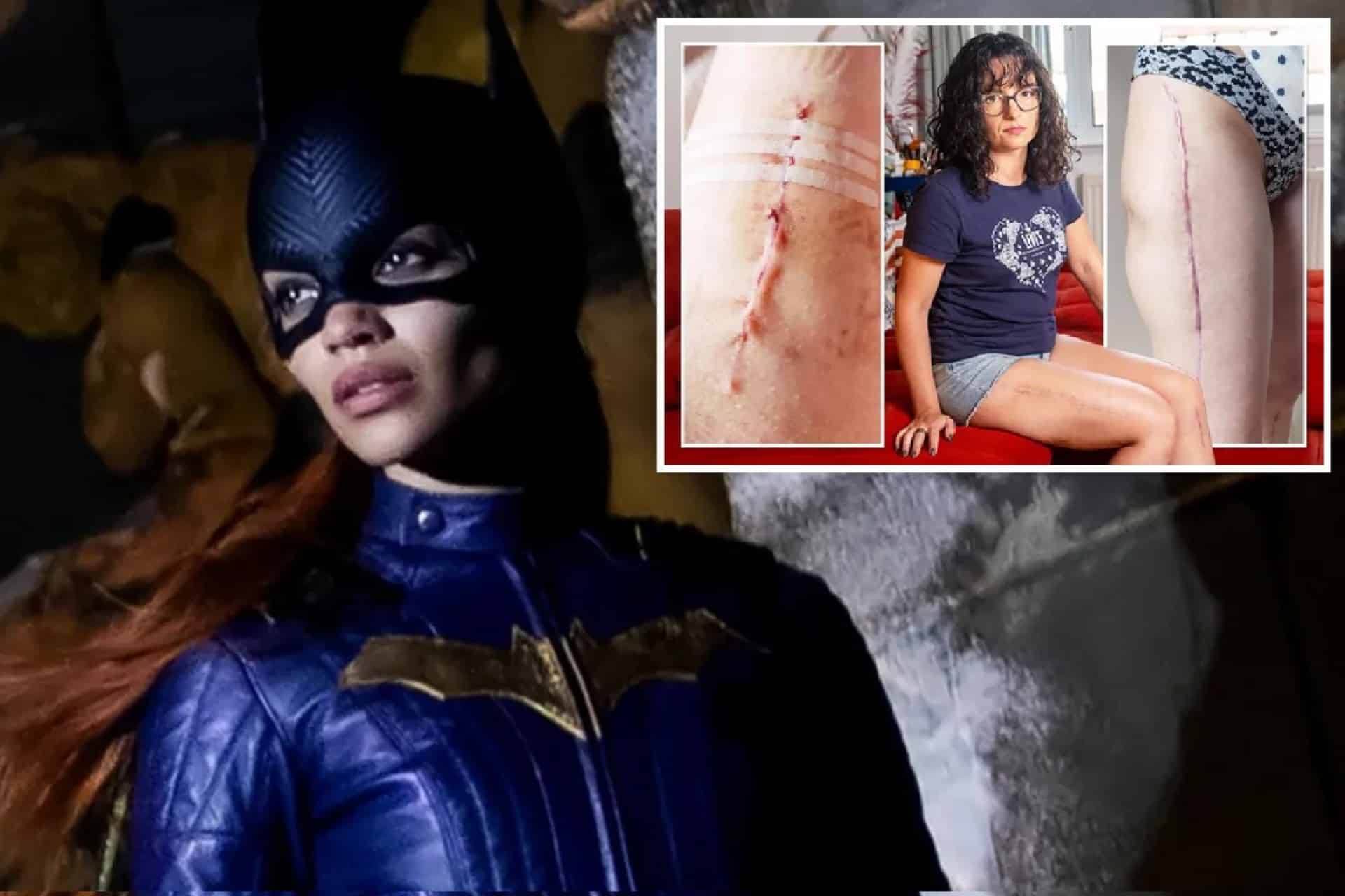 Indemnización por accidente de rodaje en Batgirl