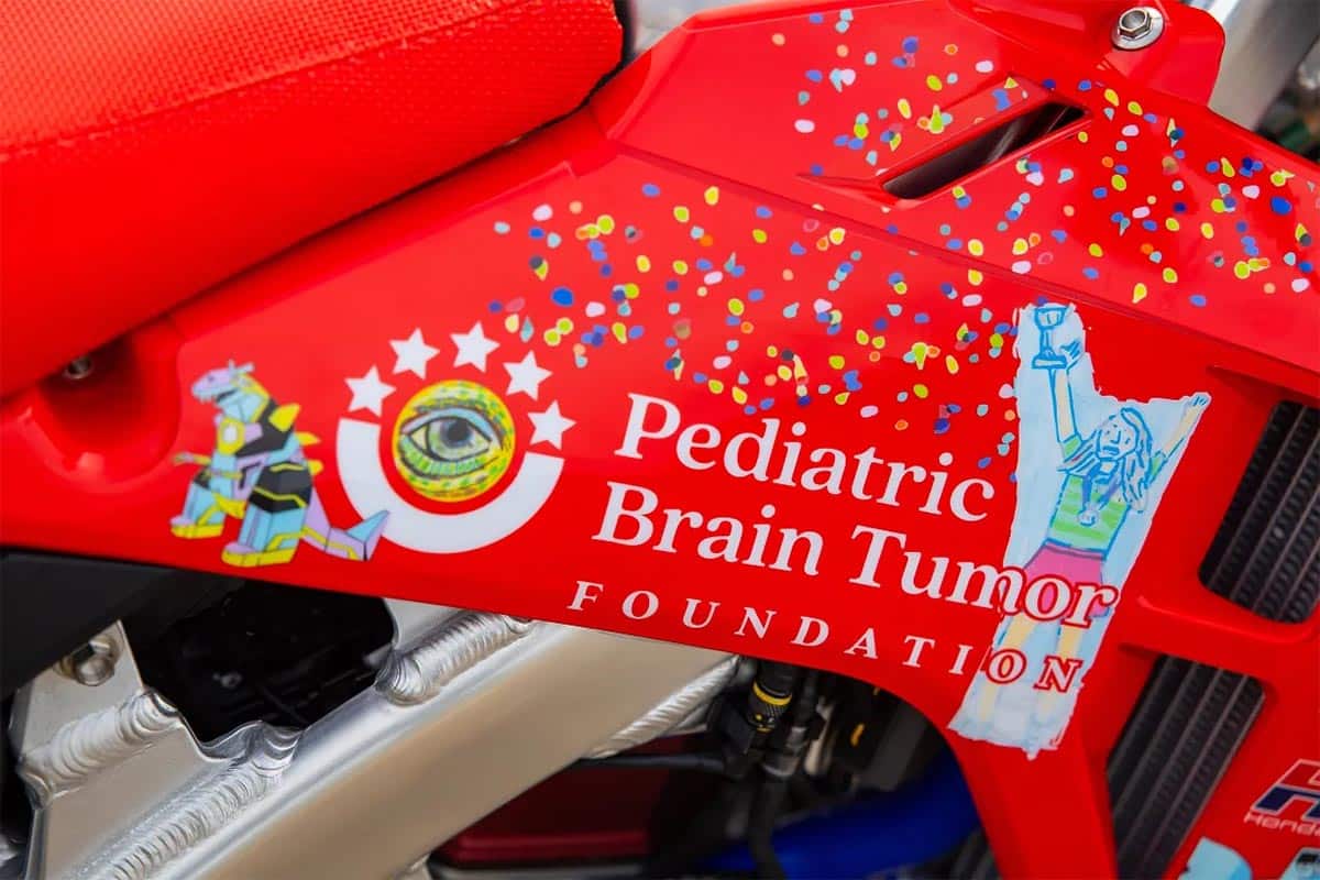 The auction is in favor of the Pediatric Brain Tumor Foundation